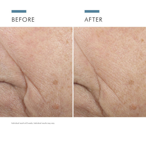 SKIN CEUTICALS | Triple Lipid Restore 2:4:2 Anti-aging Moisturiser
