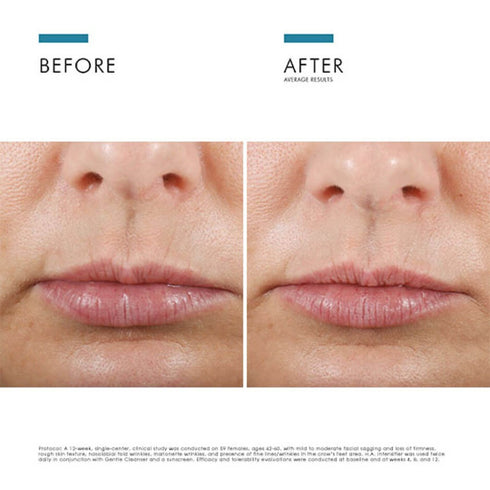 SKIN CEUTICALS | H.A. Intensifier Hyaluronic Acid Serum